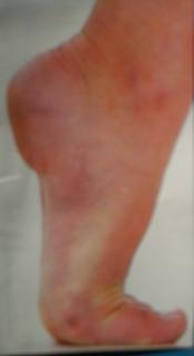 Stefany Hohnjec's Feet (603214)